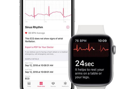 watchOS 5.1.2的正式版本将启用心电图功能