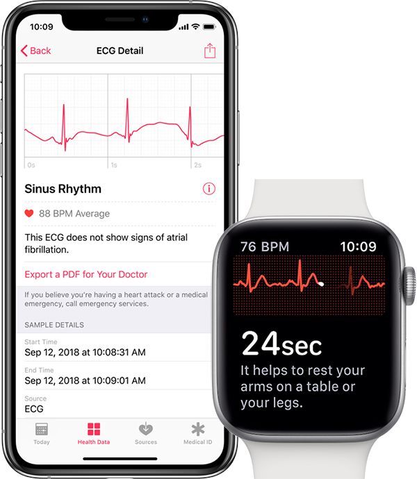 watchOS 5.1.2的正式版本将启用心电图功能