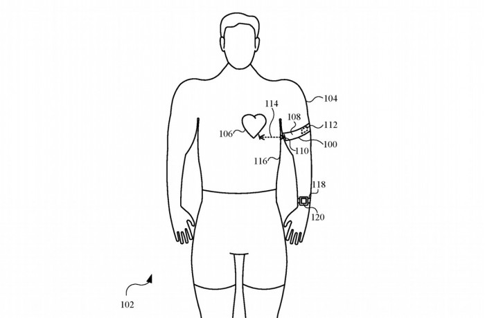 新专利显示苹果手表Apple Watch心电图可能需要一个额外的臂带