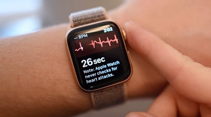 新专利显示苹果手表Apple Watch心电图可能需要一个额外的臂带